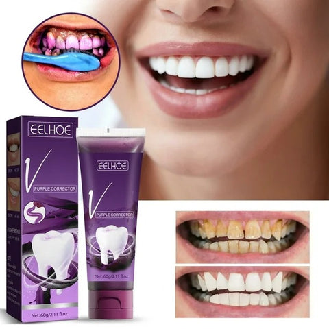 CREMA MORADA BLANQUEADOR DENTAL