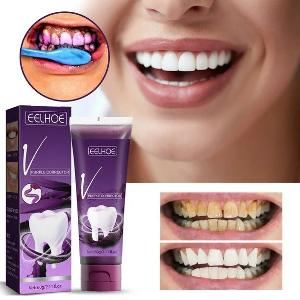 PASTA DENTAL BLANQUEADORA PURPLE